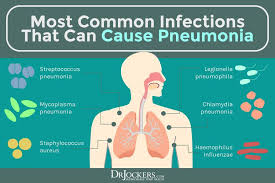 Pneumonia Causes Symptoms Solutions In 2020 Healing Solutions Pneumonia Natural Healing