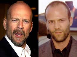 Jason statham hair loss pictures and norwood balding stage. Bald Hollywood Heart Throbs