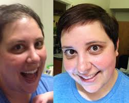 Acv stands for apple cider vinegar which is a special. A Natural Hair Treatment Pcos Diva