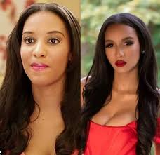 What happened to Stacey's face? That blotch