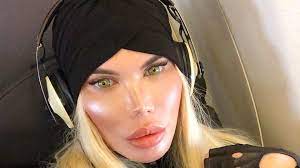 Rodrigo alves plastic surgery ken doll. Op Wahn Bei Rodrigo Alves Fake Sixpack Wird In Po Gespritzt Promiflash De