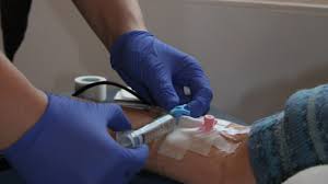 Denn nur, wenn wir verstehen wie diese krankheit entsteht und wie wir ihr entgegenwirken können, sind wir auch in der. Haufigste Krebsbehandlungen Medikamentose Krebstherapie