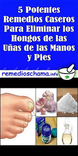 Hongos En Las Uñas De Las Manos Como Eliminarlos Pin On Remedio Casero