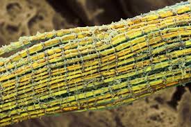 Striated muscle , which moves the skeleton and is under voluntary control; Facts About Muscle Tissue