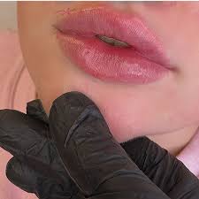 Relating to the improvement of someone's appearance. Beautifully Enhanced Lips Define By Marie Dolan In 2021 Cosmetic Clinic Lip Fillers Cosmetic Injectables