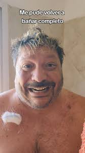 Mostrándome al descubierto por primera vez, así esta Paul hoy pero con más  ganas de vivir que nunca. Gracias a todos los que me acompañan en este  proceso con sus mensajes, saludos y apoyo ...