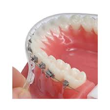 This tutorial shows you how to put wax on your braces and what's the difference between waxes! Amazon Com Tecnidentusa Clip On Comfort Lip Shield Mouth Protector Guard For Braces Orthodontic Dental Wax Alternative 2019 New And Improved Beauty