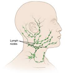 The lymph nodes in the neck have historically been divided into at least six anatomic neck lymph node levels for the purpose of head and neck cancer staging and therapy planning. Excisional Biopsy Neck Lymph Node Saint Luke S Health System