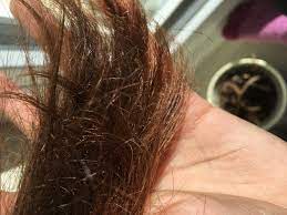 Ist Das Haarspliss Weisse Punkte Gesundheit Haare Spliss