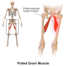 The groin is the area that lies between the abdomen (stomach) and thighs. Groin Wikipedia