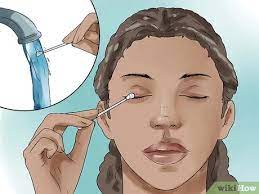 How To Get Rid Of A Stye: 11 Steps (With Pictures) - Wikihow