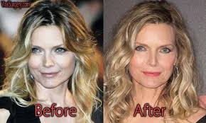 · she sticks to clean . Michelle Pfeiffer Plastic Surgery Before And After Botox Pictures