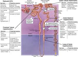Image result for Loop Diuretic