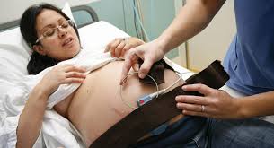 May 11, 2021 · a walk through history. Nst Test Why You May Have A Non Stress Test In Pregnancy Babycenter