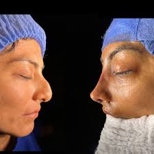 Dr. Carlos Rivas Tremont Otorrino(@carlosrivast) • Instagram 사진 및 동영상