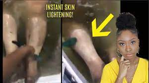 Cocoa butter and liquorice skin brightening cream: Instant Skin Bleaching Peel For Dark Skin Why I Bleached My Skin Youtube