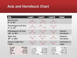 tcad multi lead ecg