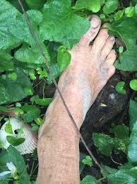 Other articles where foot is discussed: What S A Garden Toe Garden Toes