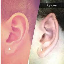 samppa von cyborg on instagram ear pointing what we did in may amazing anetavoncyborg artist bme bodymodification bodymods bodyart bodmod bestofthed