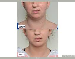 Charleston Facial Plastic Surgery