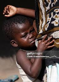 44 Measles Hand Stock Photos, High-Res Pictures, and Images