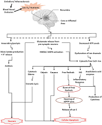 Image result for Stroke Pathophysiology