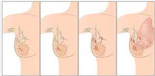 Bien sûr, des personnes remarquent que je ne porte plus rien mais je. C Est Pourquoi Vous Ne Devriez Plus Porter De Soutien Gorge Esprit Sante