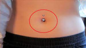 How To Get Rid Of A Belly Button Piercing Keloid Youtube