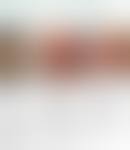 Image result for Skin Tear