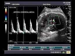 Ultrassonografia doppler colorido em veterinária. Doppler Colorido Obstetrico Andre Arnaud