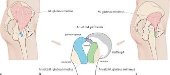 Figure 1 Knotenlose Doppelreihenrefixation Bei Glutealsehnenruptur Springerlink