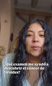 Hoy quiero compartir con ustedes el examen que me permitió descubrir el  cáncer de tiroides: la ecotomografía tiroidea. 🩺 Gracias a este examen  pude actuar a tiempo. Creo que es súper importante tener ...