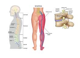 See human back anatomy stock video clips. 6 Best Homeopathic Medicines For Sciatica Pain Treatment