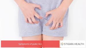 Image result for pubic lice symptoms