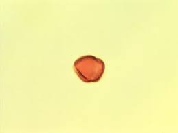 Image result for Strombosia