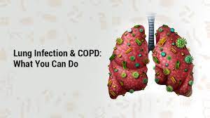 Check if you have a chest infection chest infections often follow colds or flu. Lung Infection And Copd Signs And Symptoms Lung Health Institute