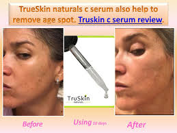 You have to thank vitamin c if your wounds heal faster than anyone else. Truskin Naturals Vitamin C Serum Review 2018 Modern Design Vitamin C Serum Reviews Vitamin C Serum Vitamins For Skin