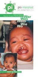 Jakob Schick's Instagram, Twitter & Facebook