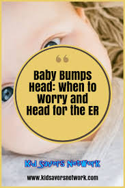 Baby Bumps Head When To Worry Head For The Er Infographic Baby Bumped Head Baby Bumps Baby Health
