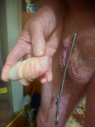 Castration penectomy porn - 72 photo