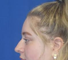 Eli Zinner's Instagram, Twitter & Facebook