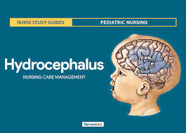 Hydrocephalus Nursing Care Planning And Management Study Guide Nursing Care Plan Nursing Care Pediatric Nursing