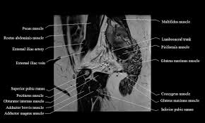 In this course, craig elliot, provides a breakdown of the female anatomy. Mri Female Pelvis Anatomy Free Mri Sagittal Cross Sectional Anatomy Of Female Pelvis