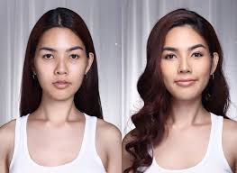 Personaliza tu paquete de cirugía