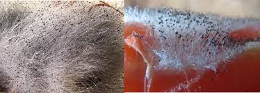 ¡mucormicosis, hongo negro que esta mutilando a pacientes con covid!la mucormicosis es una enfermedad producida por hongos, q. Mucormicosis La Enfermedad Producida Por El Hongo Negro Gaceta Fm