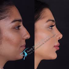 İstanbul aesthetic center is located in istanbul and specializes in plastic surgery. Dr Suleyman Tas Md Aesthetic And Plastic Surgeon In Istanbul Turkey Read 124 Reviews
