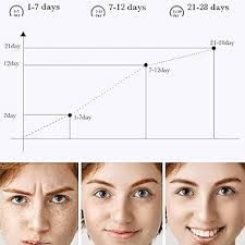 Amazon.com: Dark Spot Remover for Face, Niacinamide Crema Manchas  Oscuras,20g Crema Premium Manchas Edad, Dark Spots