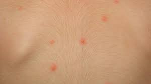 We did not find results for: á… Pickel An Der Schulter Und Am Rucken