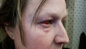 Fundraiser by Cari D. : Help Cari