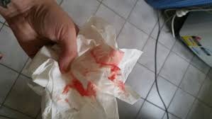 Bloody show is a type of vaginal discharge that occurs during late pregnancy. Do You Think This Is A Bloody Show December 2015 Babycenter Australia